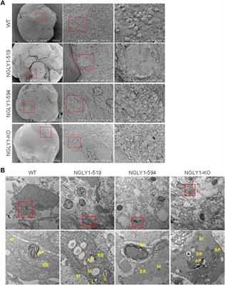 Generation and characterization of NGLY1 patient-derived midbrain organoids